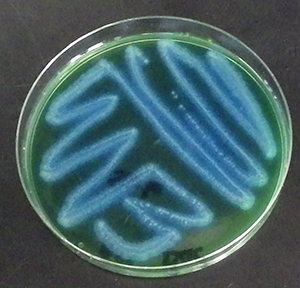 Bacillus cereusagar